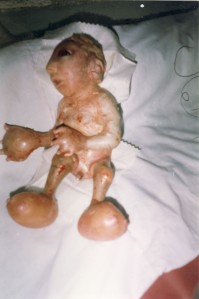 Bomben-Demokratie in Afghanistan